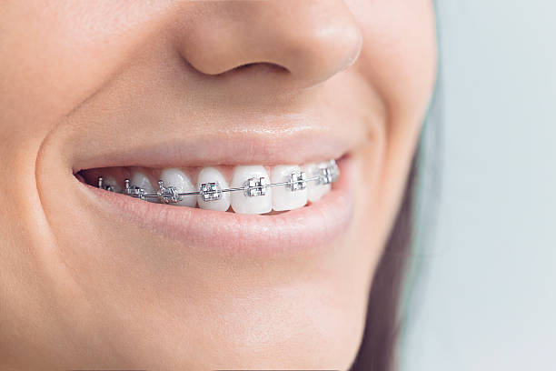 Best Traditional Braces  in Essex Fells, NJ